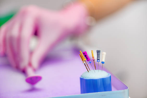 Endodoncie v Praze: Záchrana zubu díky moderní technologii